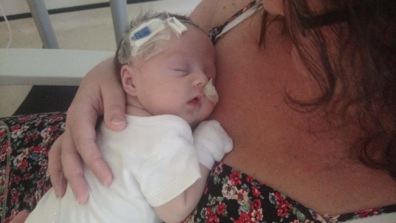 malattie rare aiuto neonata Lidia malformazione genetica appello padre foto