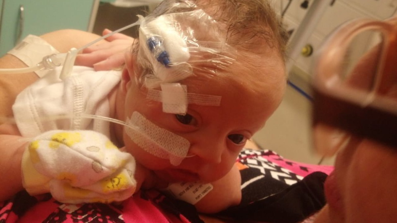 Malattie rare, un aiuto per la neonata Lidia: le foto