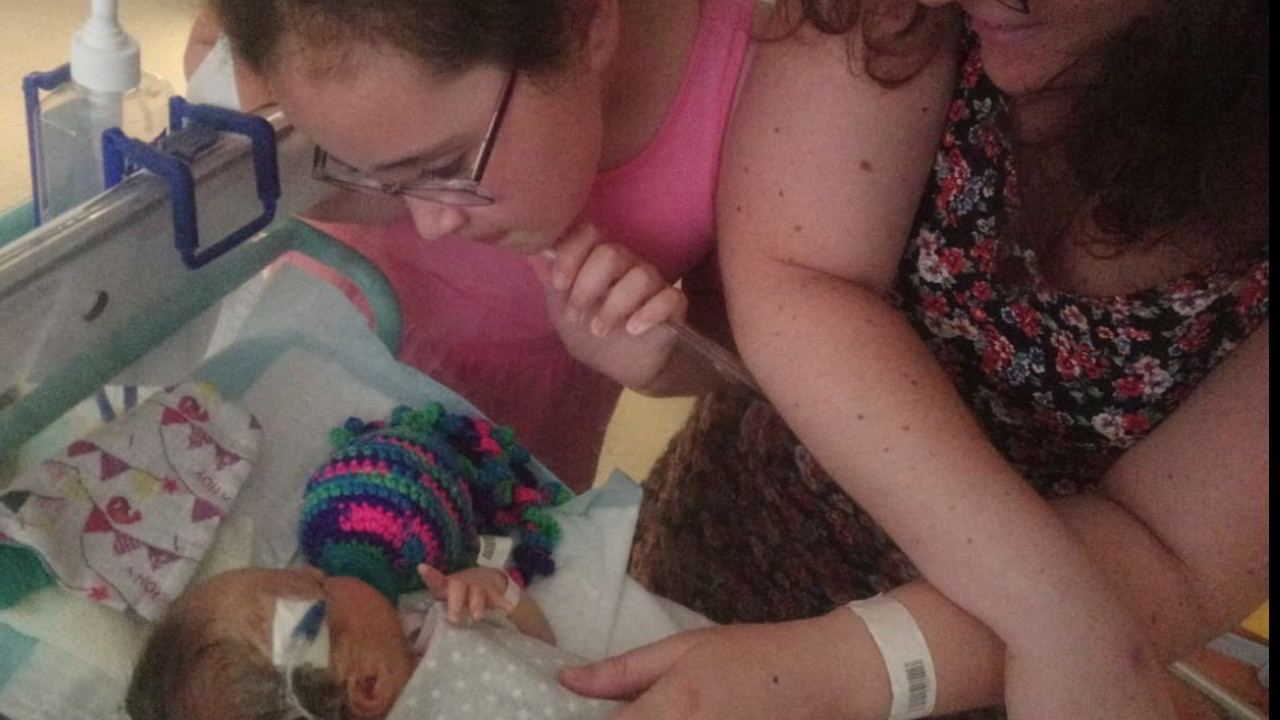 Malattie rare, un aiuto per la neonata Lidia: le foto