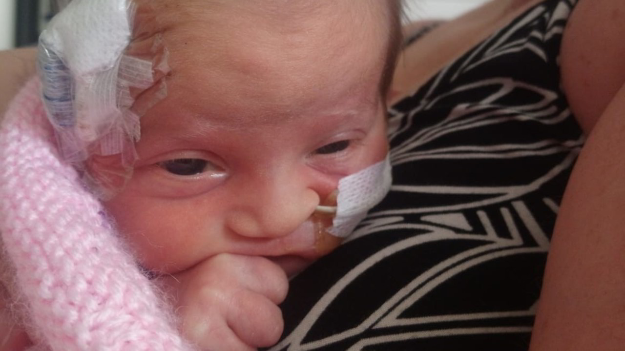 Malattie rare, un aiuto per la neonata Lidia: le foto