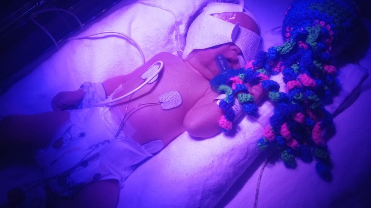 Malattie rare, un aiuto per la neonata Lidia: le foto