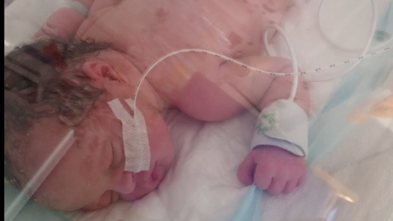 Malattie rare, un aiuto per la neonata Lidia: le foto