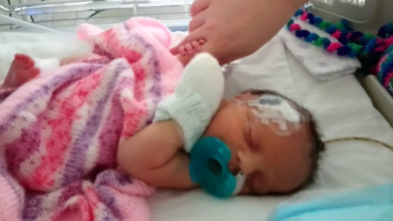 Malattie rare, un aiuto per la neonata Lidia: le foto