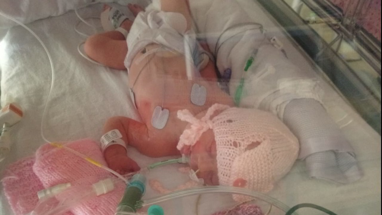 Malattie rare, un aiuto per la neonata Lidia: le foto