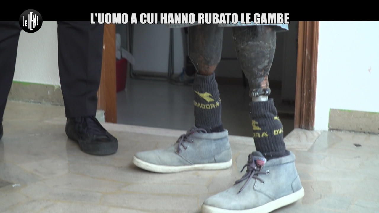 gambe protesi brevetto rubato