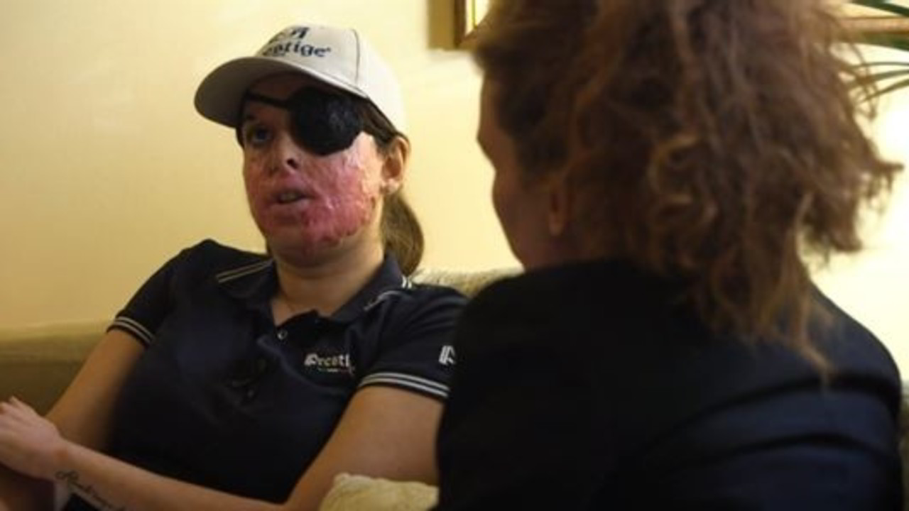 Sfregiata Con L Acido I Giudici Tavares Voleva Privare Gessica Dell Identita Video Le Iene