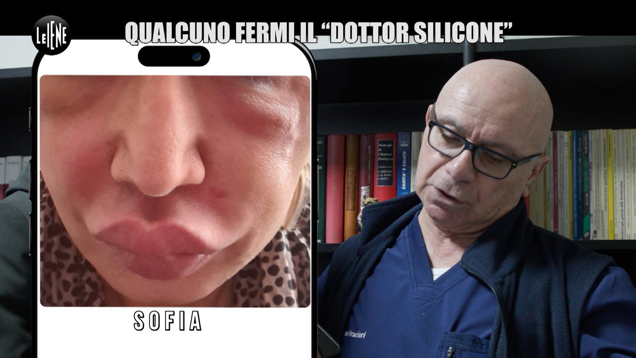 MARTINELLI: Qualcuno fermi il “dottor silicone” MARTINELLI: Qualcuno fermi il “dottor silicone”